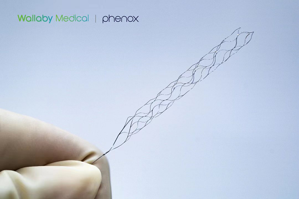 沃比医疗旗下phenox公司宣布其pRESET取栓支架获得FDA认证