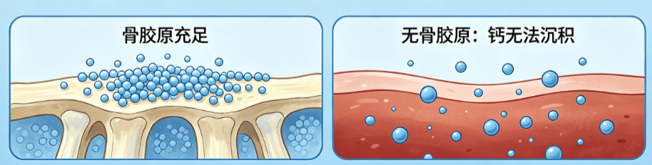 结石体质如何科学养护骨骼？补钙不长石的秘密，就藏在骨胶原里